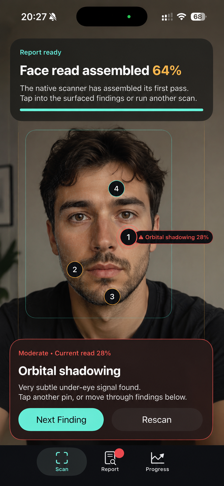 GlowReport scan highlighting orbital shadowing on a live face scan.