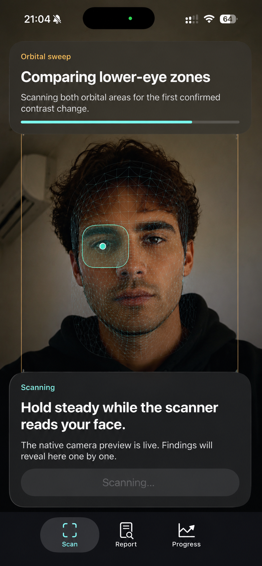 GlowReport live scan screen comparing lower-eye zones during a scan.